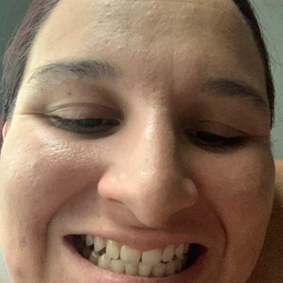 Whitening toothpaste! - Picture 9 of 11